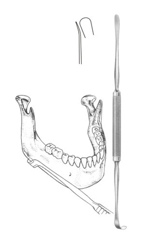 Mandibular Inferior Border Raspatories